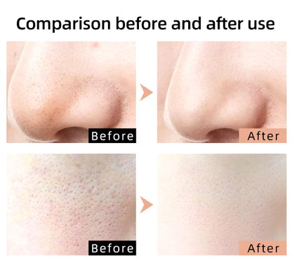 Mask Skin Rejuvenation Photon